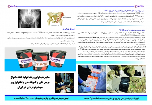کمربند شکستگی لگن TPOD