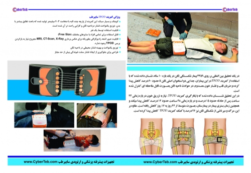 کمربند شکستگی لگن TPOD