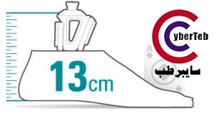پروتز پای پنجه کربنی Velocity