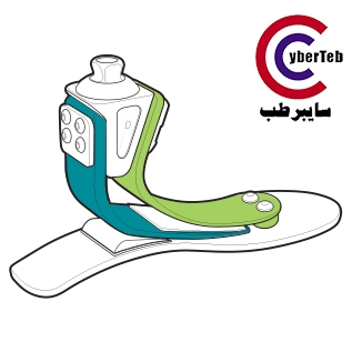 پروتز پای پنجه کربنی Velocity