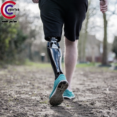 پروتز زیر زانو  اتوبوک اوسر