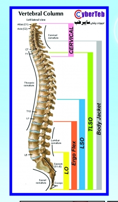 کمربند طبی پیشرفته قرقره ای سایبرتک Comprehensive LSO